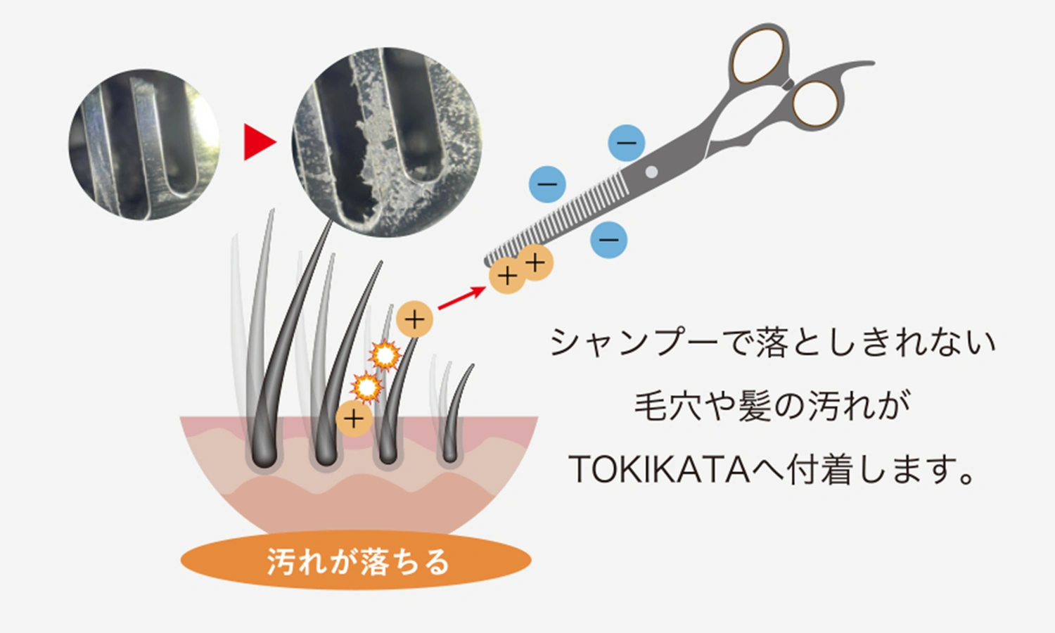 皮脂除去の図解